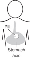 An illustration shows pills in the stomach and stomach acid secreted inside the stomach.