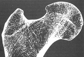 28. X-ray through a bone showing the arrangement of bony trabeculae