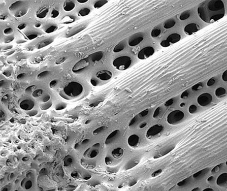 37–38. Close-up photographs showing the remarkable structure of sea urchin spines