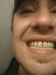 A close-up of the mouth can highlight a smile.