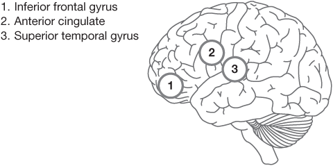 FIGURE 4.4 The brain regions involved in processing metaphor.