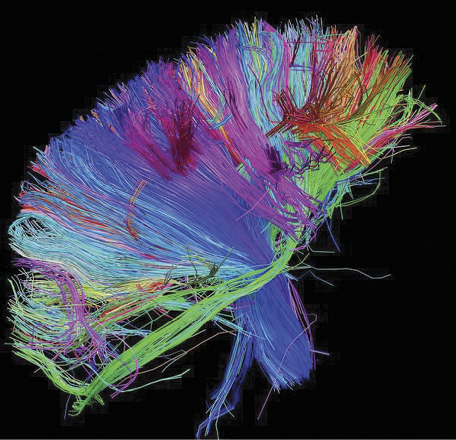 Image of Three-dimensional internal structure of connections within a brain