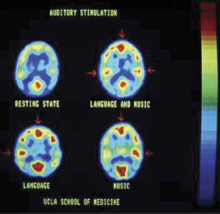 Image of PET image showing brain activity during performance of certain tasks by research subject