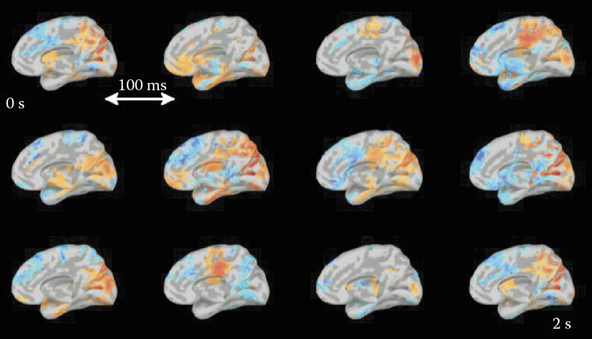 Image of Dynamic processes occurring within a brain