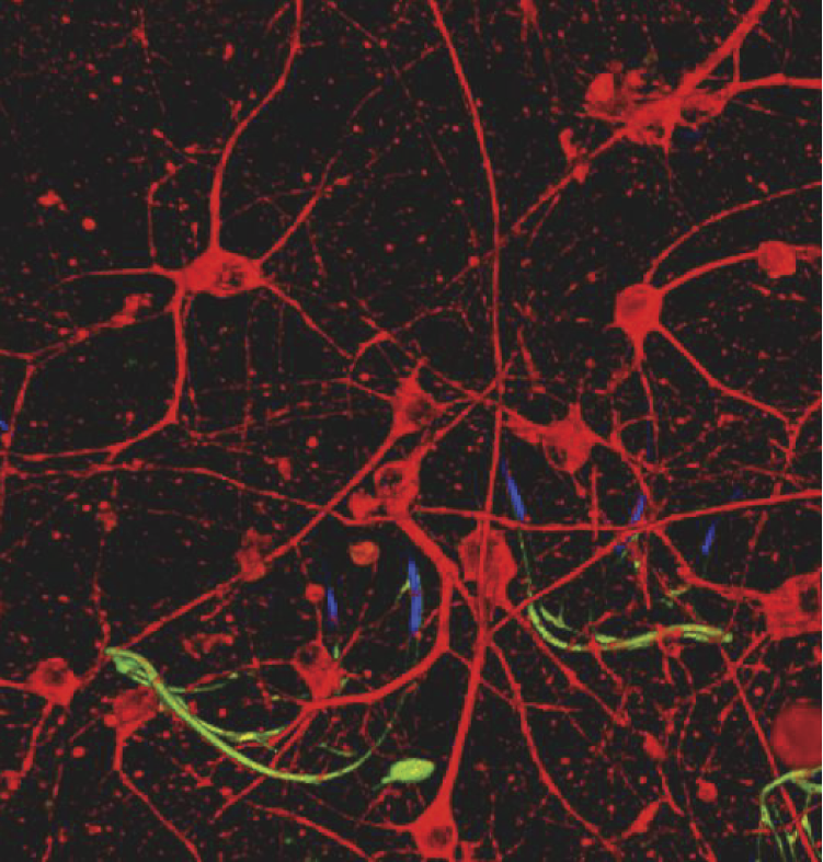 Image of Artificial neural net with structure based on three-dimensional brain map