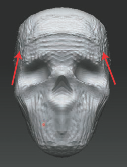 Adjusting the angle of the cheekbones to the brow ridge