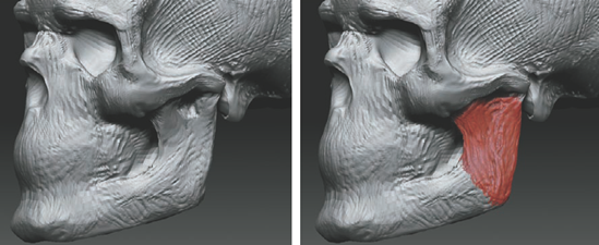 Sculpting the masseter muscle