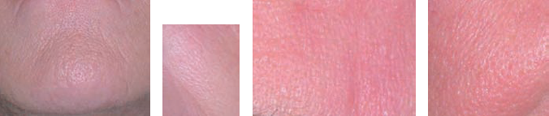 A selection of skin pores. Notice how pores change shape over the course of the face.
