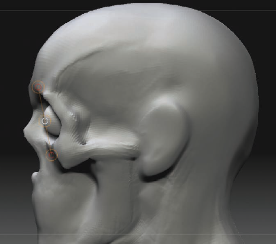 Moving the eye back so it sits on the diagonal line shown between the brow ridge and zygomatic bone