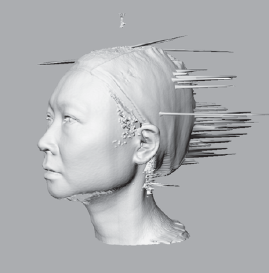 A 3D scan of a head with anomalies