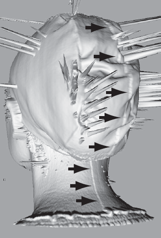 The ridge line representing the start and end of the 3D scan