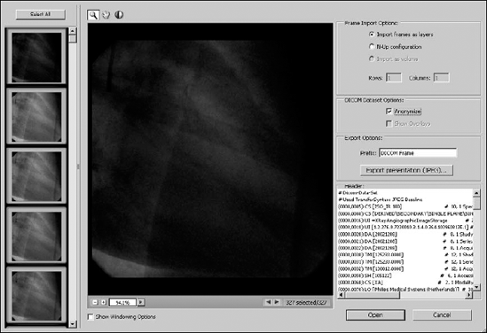 You can open a DICOM file in several ways, or you can simply export it to a .jpg. In this example, you want to animate it, so we need to create a layer for each image in the DICOM file.