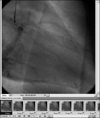 The Animation (Frames) panel shows more clearly how each image has become a frame in this new DICOM animation.