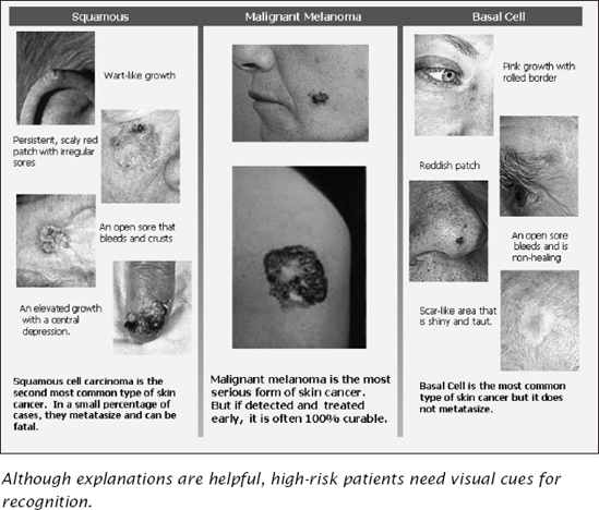 A Graphics-Dominant Brochure on Skin Cancer.