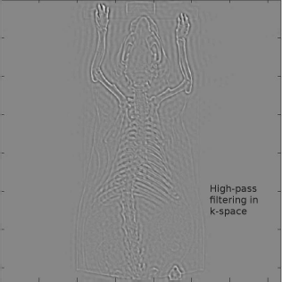 Figure showing the results of a simple high pass filter in k-space applied to MouseCT.jpg. Image data courtesy of C. Kuntner, AIT Seibersdorf, Austria.