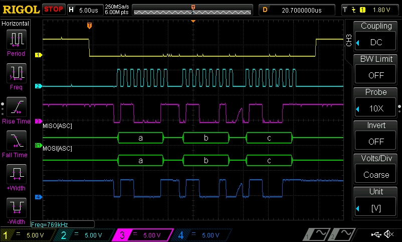 SPI