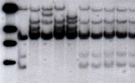 Autoradiograph of a DNA cut with the enzyme Hind III and revealed by a radioactive probe (RFLP).
