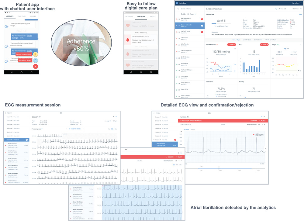 Screenshots of interfaces of patient app with chatbot, easy-to-follow digital care plan, ECG measurement session, detailed ECG view and confirmation/rejection, and atrial fibrillation detected by analytics.