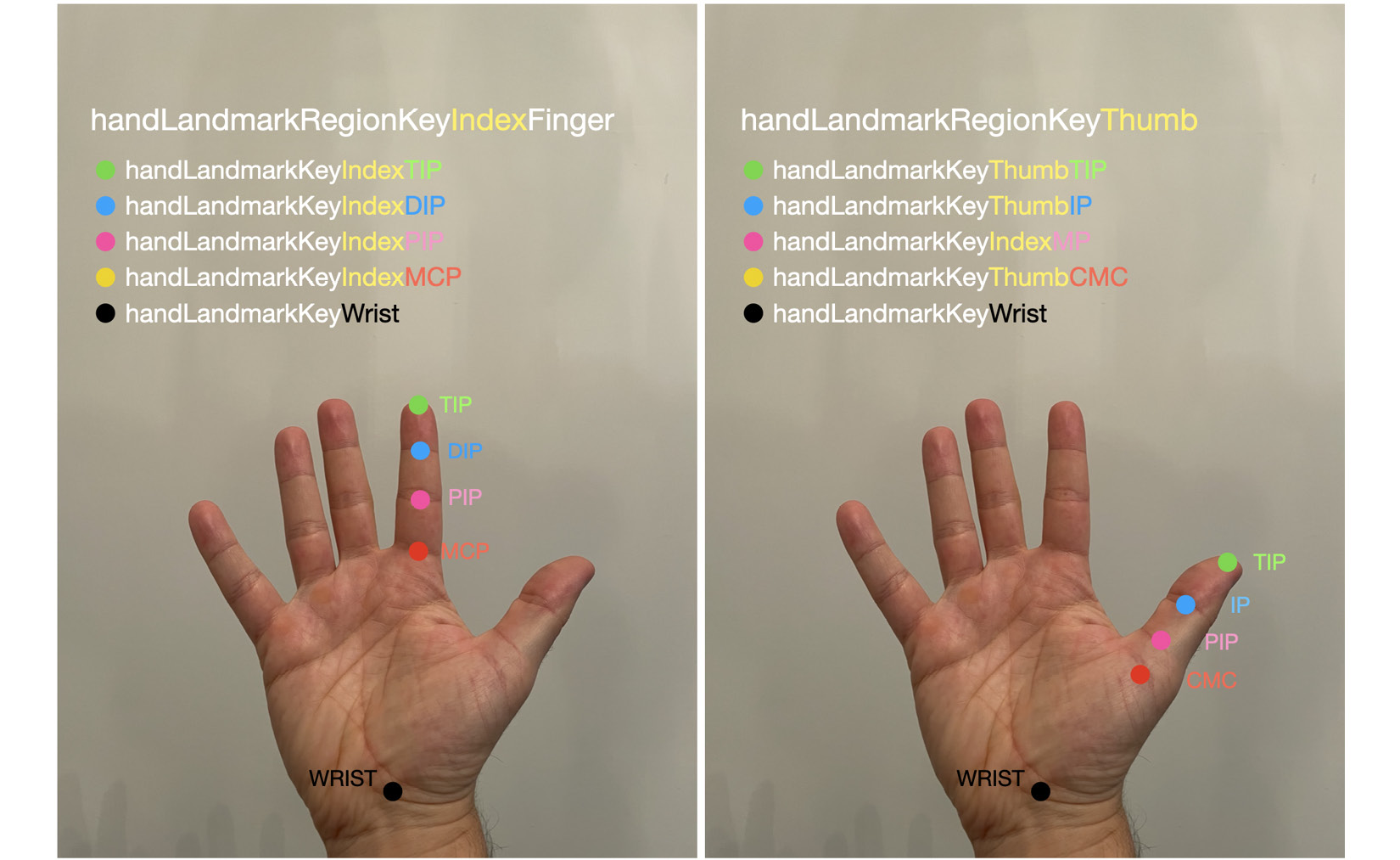 Figure 15.04 – Finger and thumb landmarks
