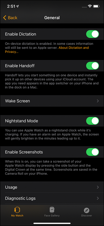 Snapshot of tweaking a number of options in the Apple Watch app on your iPhone, including transferring activities to other Apple products.