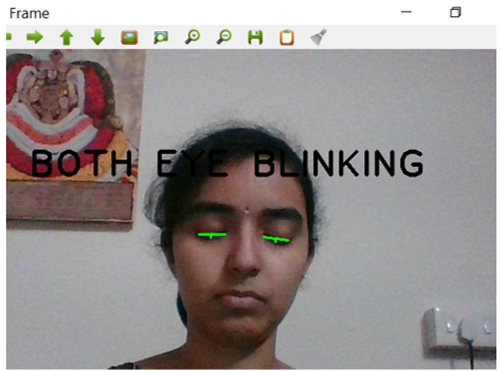 Schematic illustration of both eye blink detection.