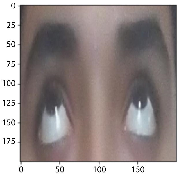 Schematic illustration of up gaze.