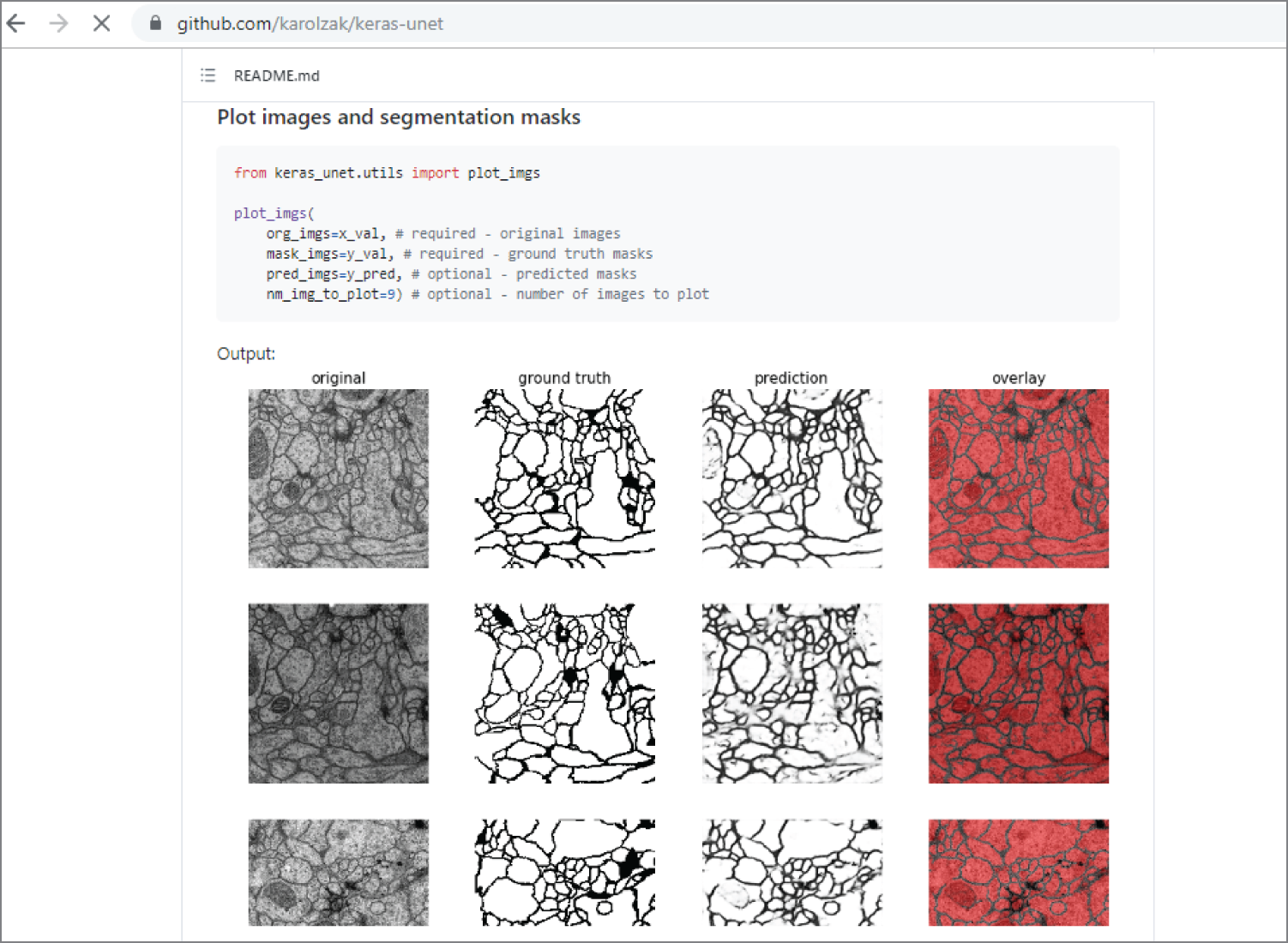 Snapshot of the Keras-Unet library GitHub website with serial section Transmission Electron Microscopy images.