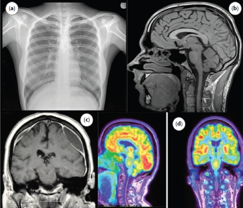 Photographs of the digital medical images: (a) X-ray of chest, (b) MRI imaging of brain, (c) CT scan of brain, and (d) PET scan of brain.