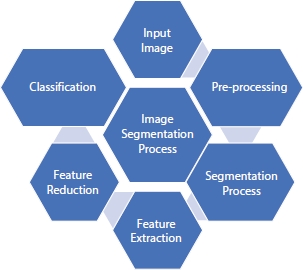 Schematic illustration of the image segmentation process flow.
