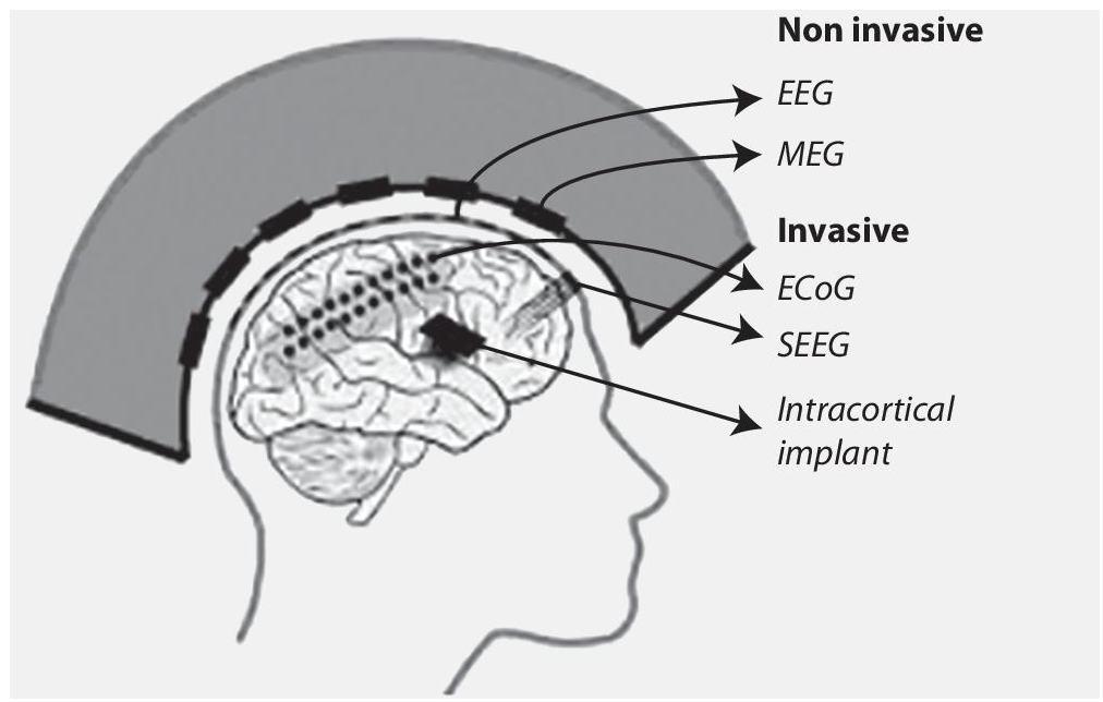 Schematic illustration of the recording places in/on brain.