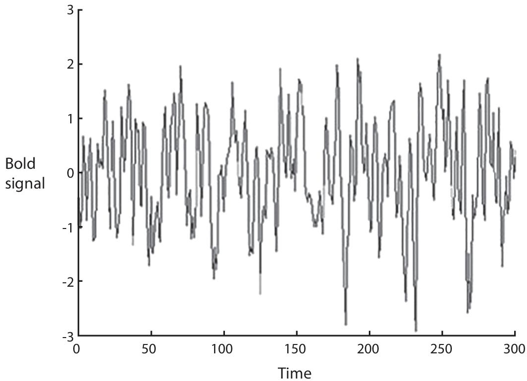 Schematic illustration of rsfMRI bold signal of depression disorder.