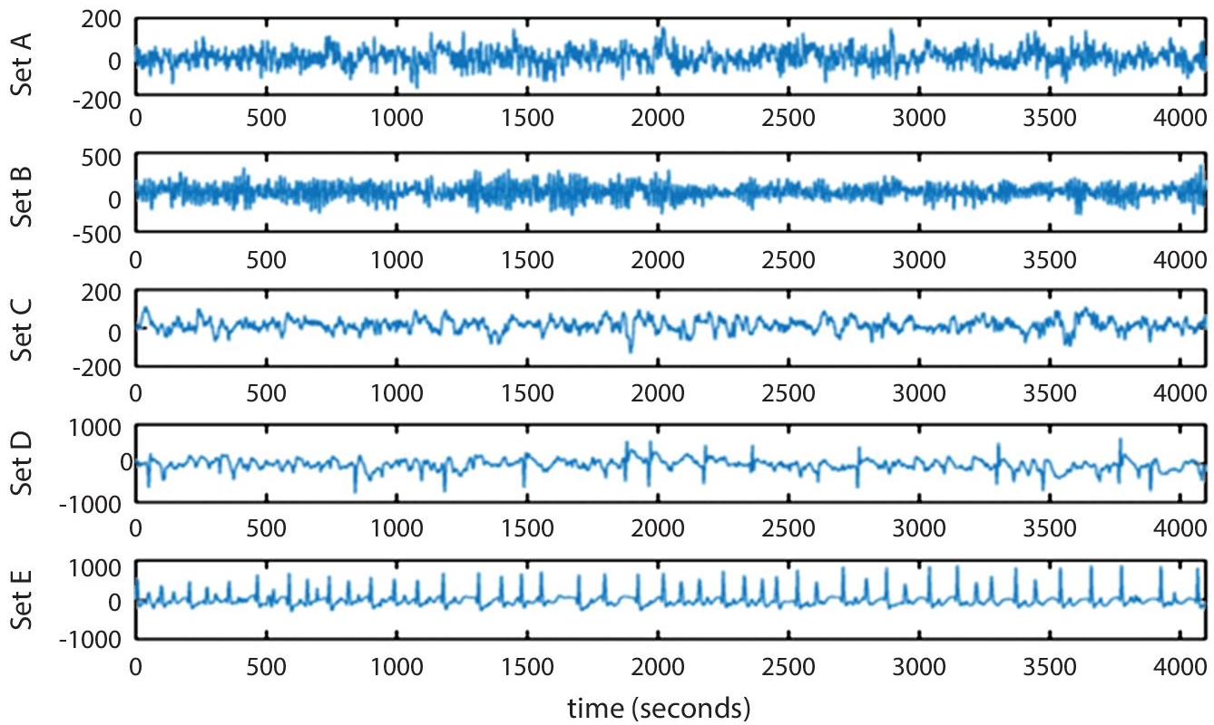 Schematic illustration of seizure detection.