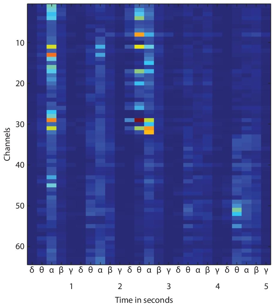 Schematic illustration of activity map for an EEG trial.