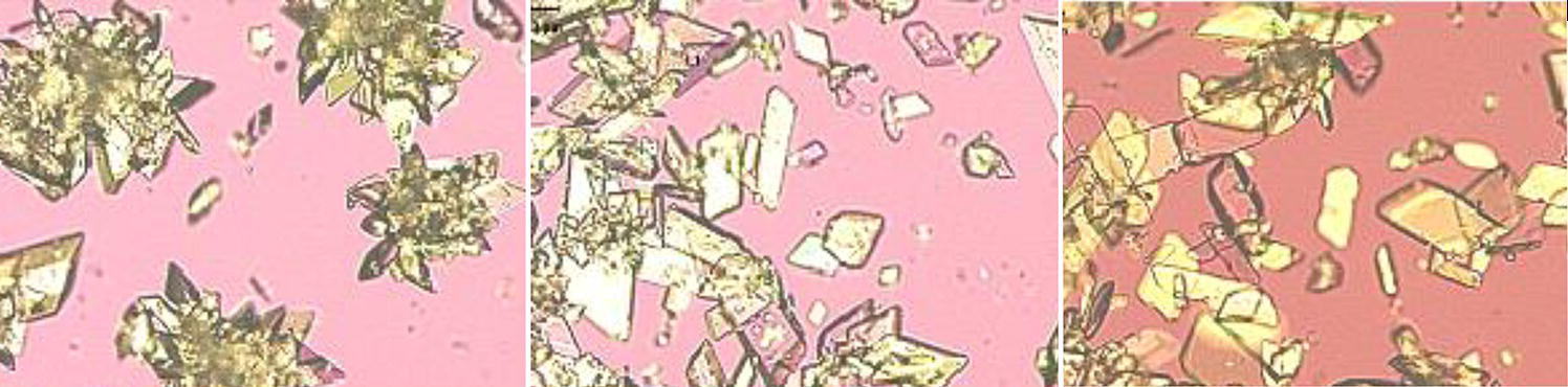 Schematic illustration of microscopic photos of crystals under different supersaturation—29 mg/ml (left), 15 mg/ml (middle), and 9 mg/ml (right).