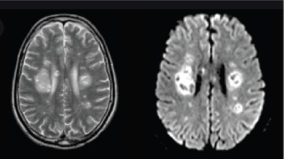 Schematic illustration of brain MRI image.