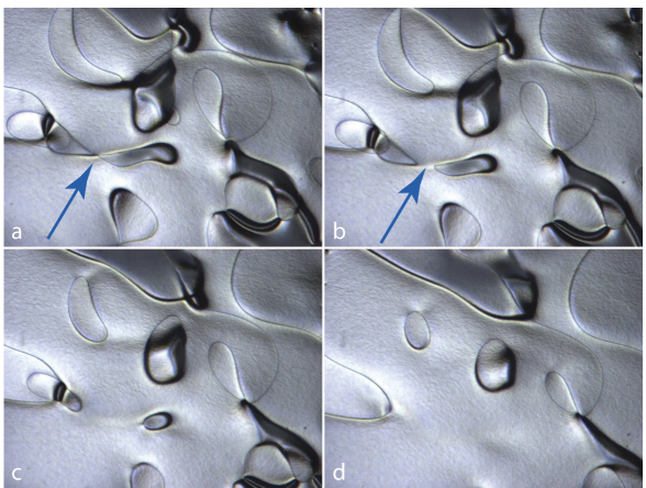 Photos depict the spontaneous shrinking and collapse of disclination loops in a nematic droplet. 
