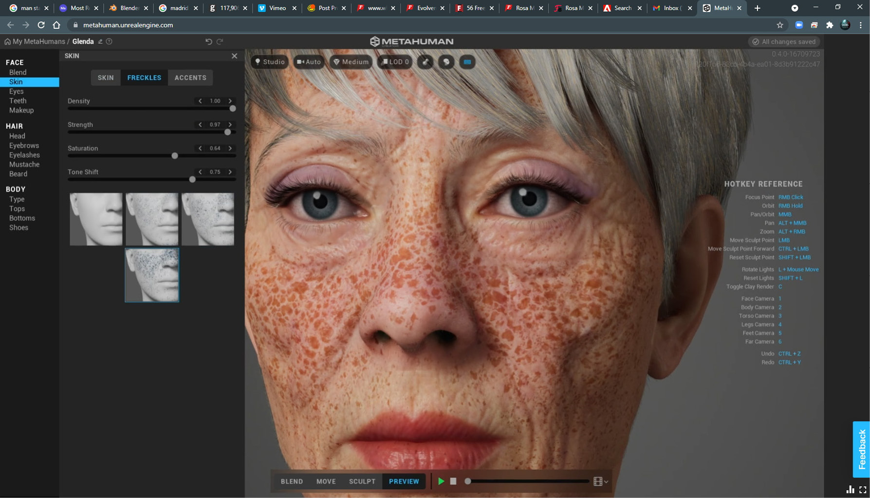 Figure 2.14: Freckles
