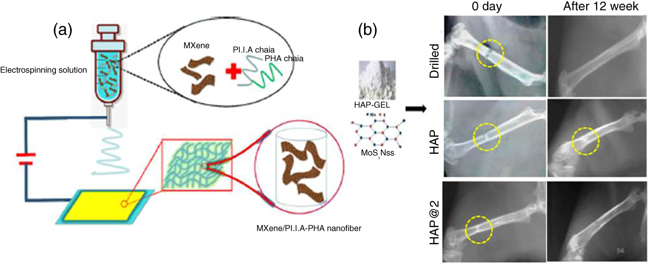Schematic illustration of (a) Electrospinning method to fabricate the MXene composite. (b) The radiological images of HAP and HAP@2 scaffolds implanted in rat femur and bone regeneration monitored after 12 weeks.