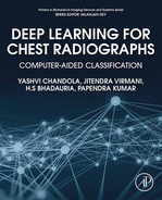 Deep Learning for Chest Radiographs 